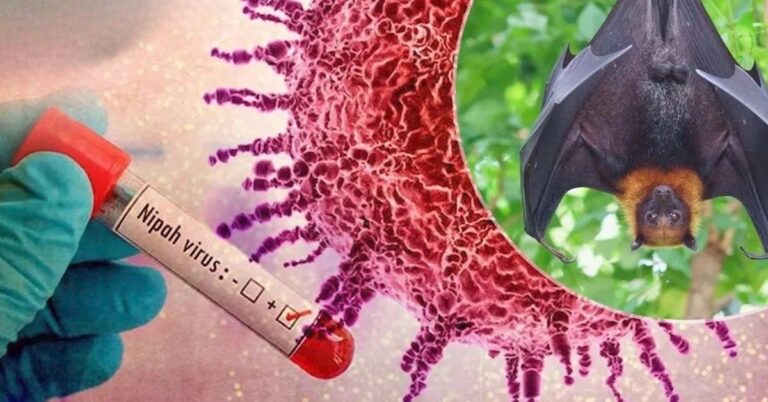 virus nipah